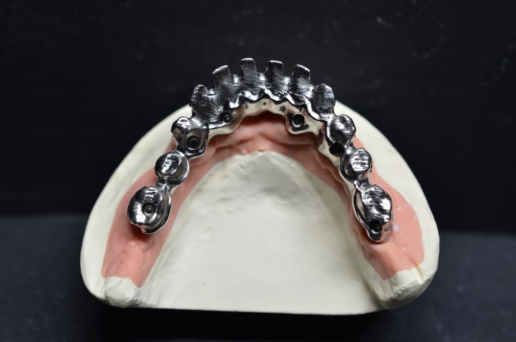 Dental Team - Studio Odontotecnico a Firenze - protesi fissa Toronto bridge